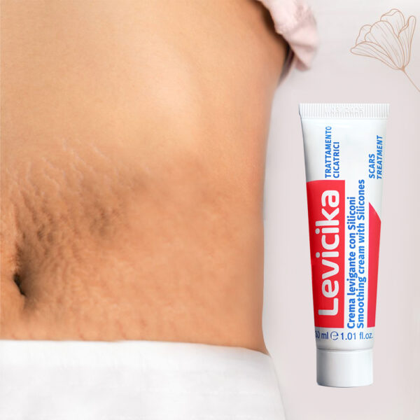 Levicika | Scar-reduction Cream | Suitable for all Scar Types | 30 ml